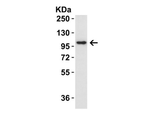 Western Blot of IL-17RA