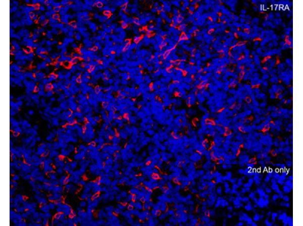Immunofluorescence of IL-17RA