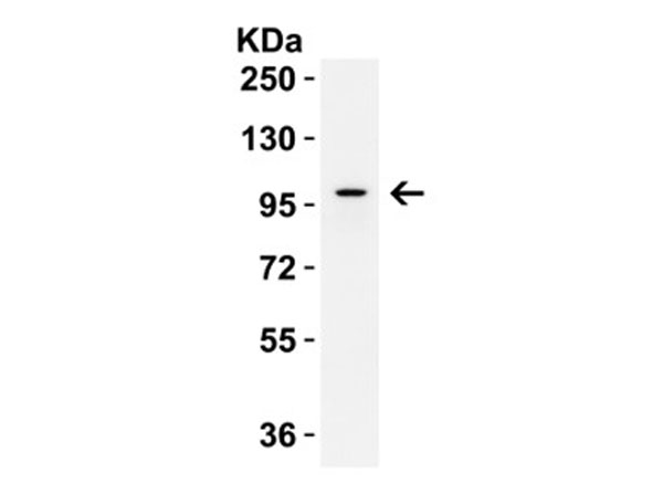 Western Blot of IL-17RA