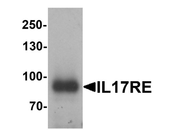 Western blot analysis of IL-17RE