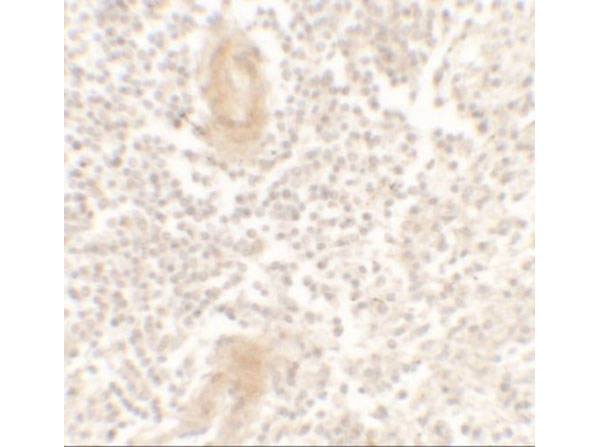 Immunohistochemistry of IL-1F10