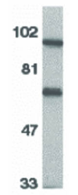 Western Blot of IL-1RAcP Antibody