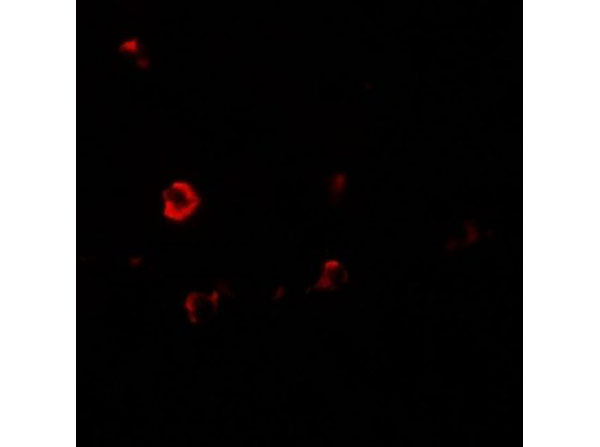 Immunofluorescence of IL-1RL2