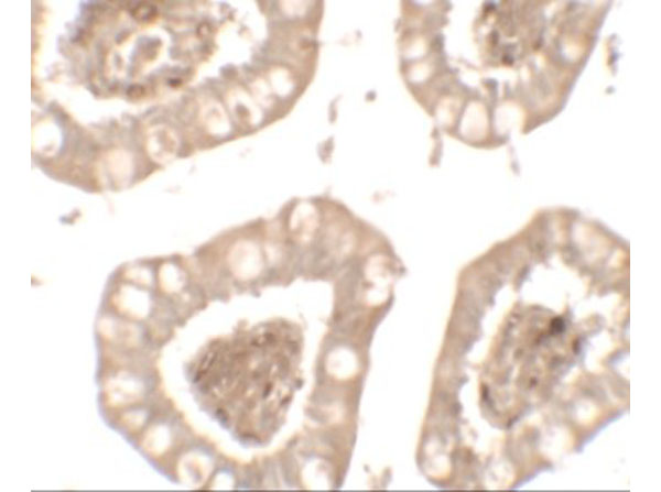 Immunohistochemistry of IL-1RL2