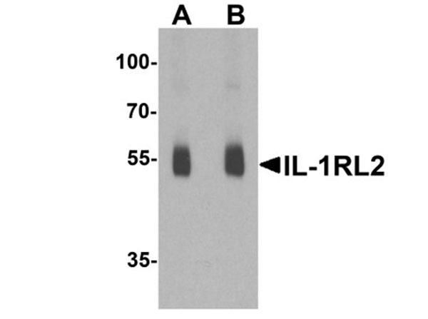 Western blot of IL-1RL2