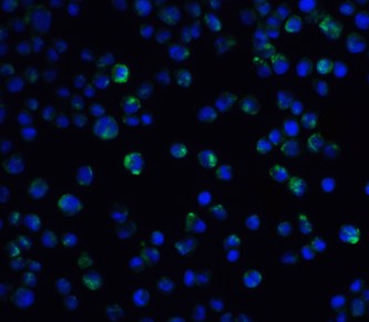 Immunofluorescence of IL21R