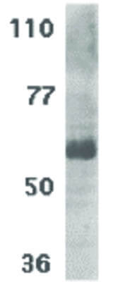Western Blot of IL-21 Receptor Antibody