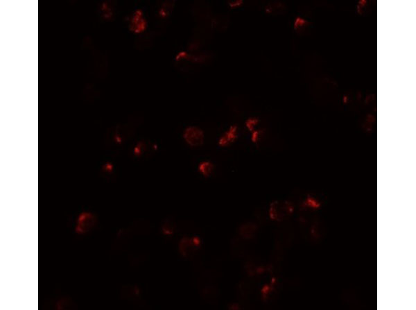 Immunofluorescence of IL-22