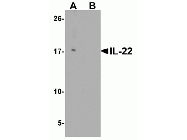 Western blot of IL-22