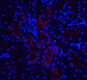 Immunofluorescence of IL-22R