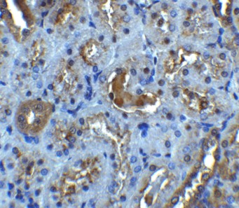 Immunohistochemistry of IL-22R