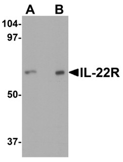 Western blot analysis of IL-22 receptor