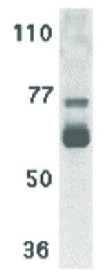 Western Blot of IL-22 Receptor Antibody
