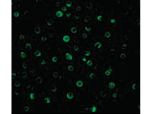 Immunofluorescence of IL-22 Receptor Antibody