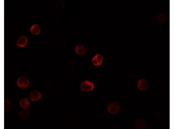 Immunofluorescence of IL-28B