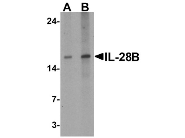 Western blot of IL-28B