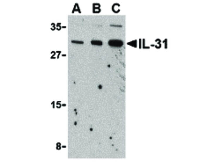 Western Blot of IL-31 Antibody
