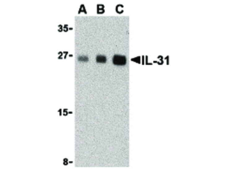Western Blot of IL-31 Antibody