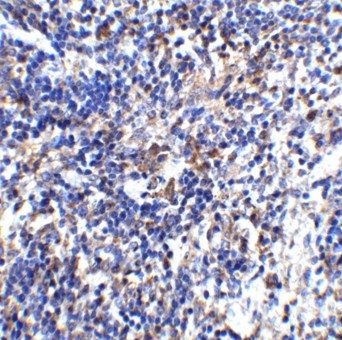 Immunohistochemistry Validation of IL-32