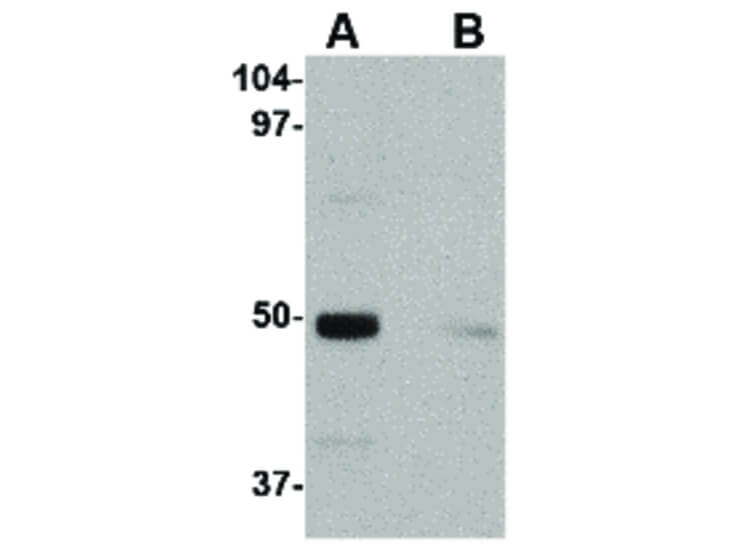 Western Blot of IL-34 Antibody