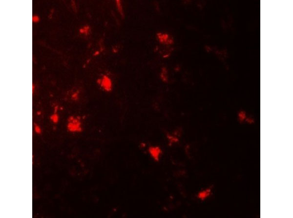 Immunofluorescence of IL-36A