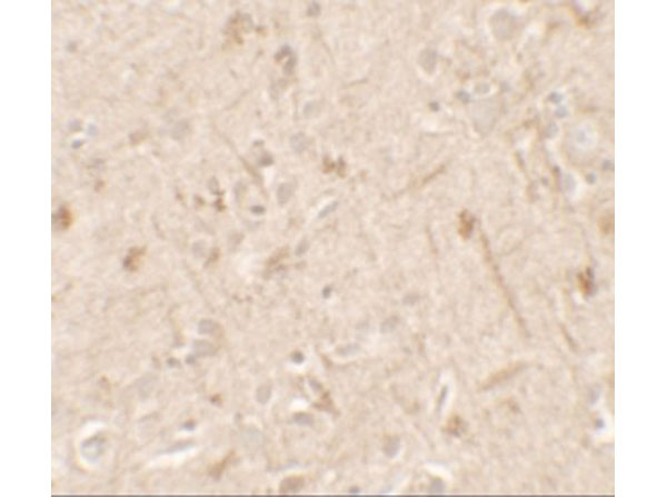 Immunohistochemistry of IL-36A