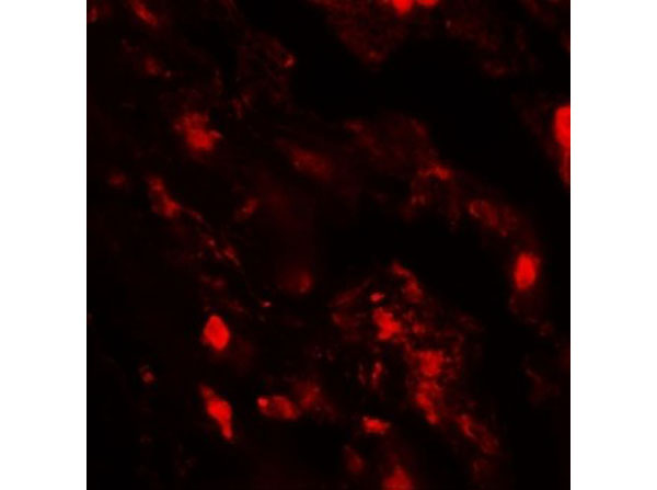 Immunofluorescence of IL-36B
