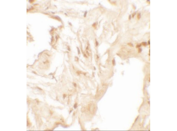 Immunohistochemistry of IL-36B
