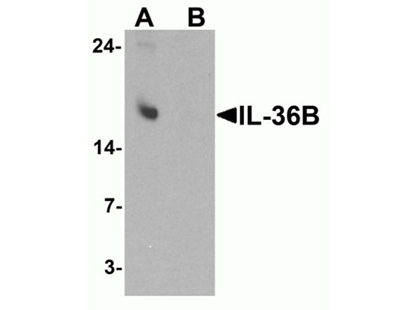 Western blot of IL-36B