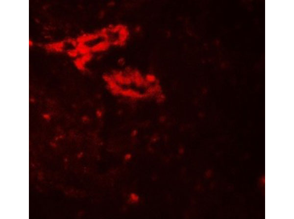 Immunofluorescence of IL-36G