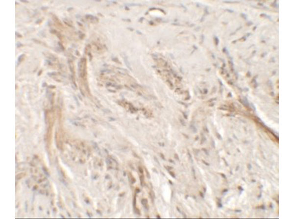 Immunohistochemistry of IL-36G