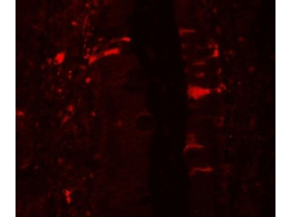 Immunofluorescence of IL-36RN