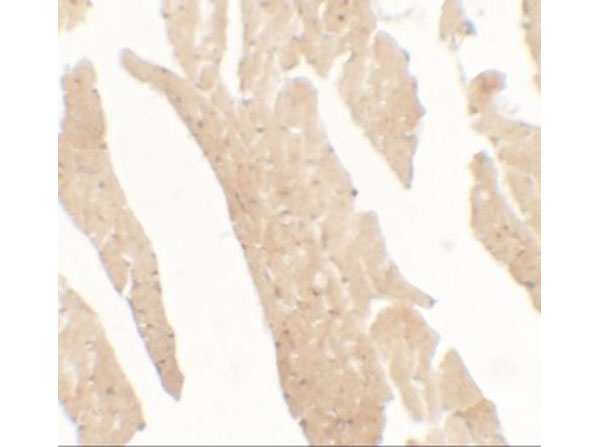Immunohistochemistry of IL-36RN