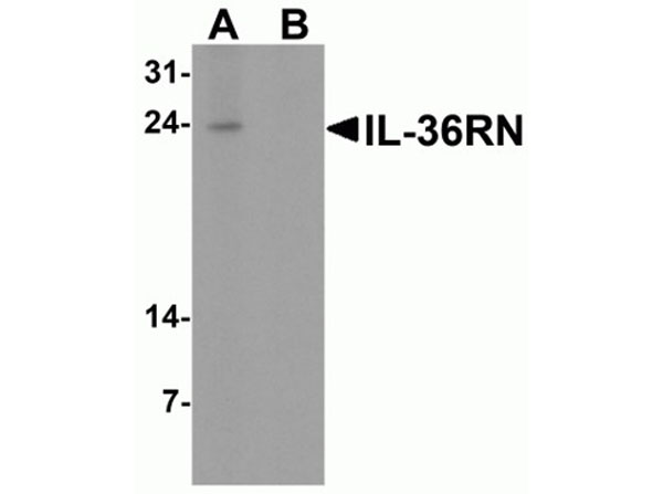 Western blot of IL-36RN