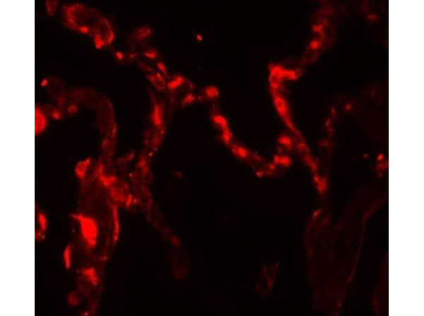 Immunofluorescence of IL-37