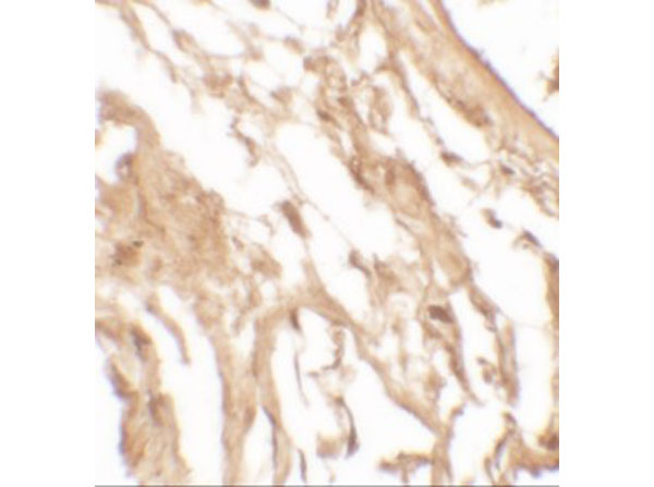 Immunohistochemistry of IL-37