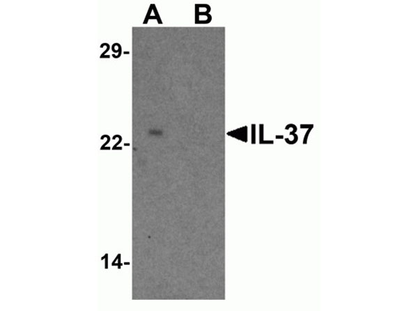 Western blot of IL-37