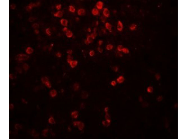 Immunofluorescence of IL-9