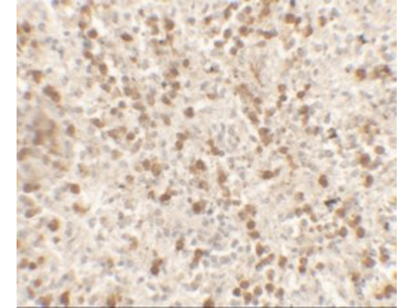 Immunohistochemistry of IL-9
