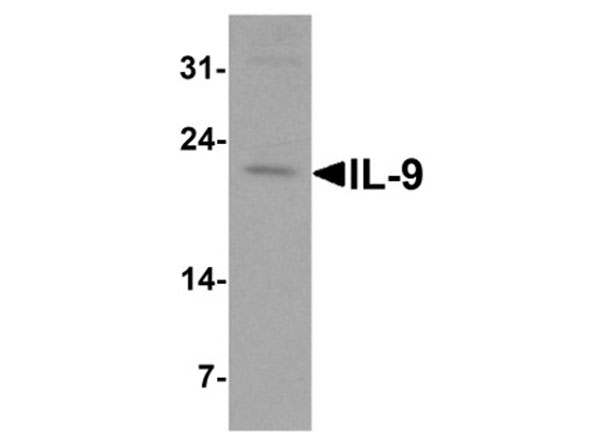 Western Blot of IL-9