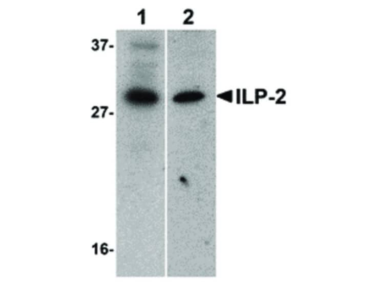 Western Blot of ILP-2 Antibody