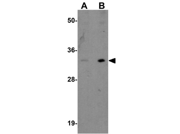 Western blot analysis of INKA1