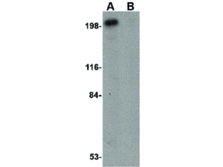 Western Blot of Integrin alpha 4 Antibody