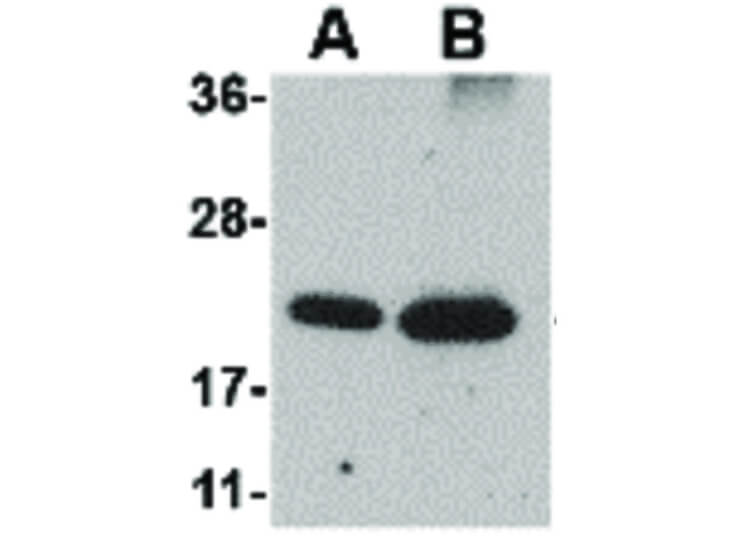 Western Blot of Integrin alpha 4 Antibody