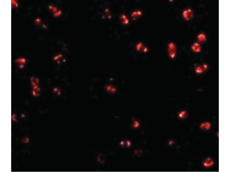 Immunofluorescence of Integrin alpha 4 Antibody