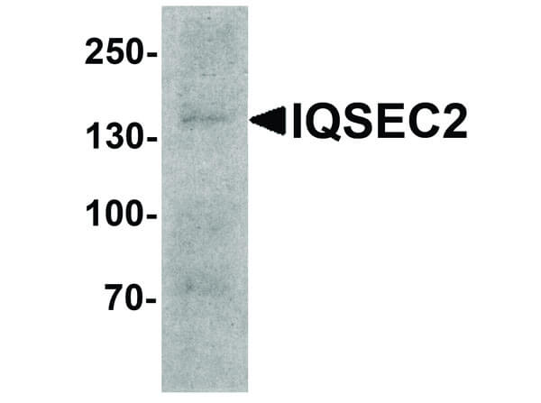 Western Blot of IQSEC2 Antibody