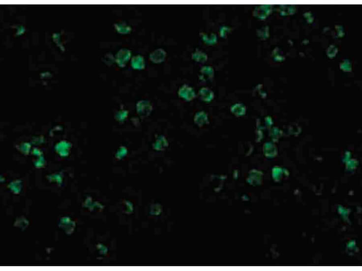 Immunofluorescence of IRAK2 Antibody