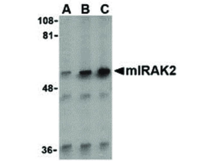 Western Blot of IRAK2 Antibody