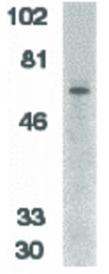 Western Blot of IRAK-2 Antibody