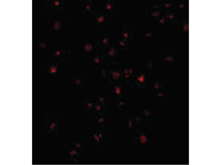 Immunofluorescence of IRE1p Antibody